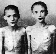 Image result for Josef Mengele Medical Experiments On Twins
