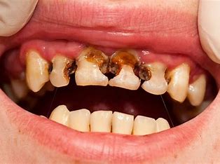 Obrázkové výsledky pre: zuby