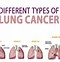 Image result for Types Treatment Lung Cancer