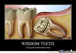 Image result for Wisdom Teeth Funny Quotes