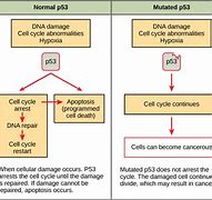 Image result for Stage 4 Cancer Cells