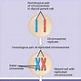 Image result for Williams Syndrome Chromosome Pic