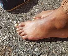 Image result for Dillyn Dryer Feet