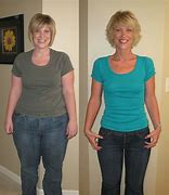 Image result for Weight Loss Surgery
