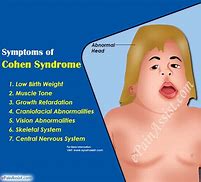 Image result for Cohen Syndrome