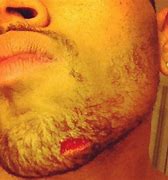 Image result for Chris Brown Got Beat Up