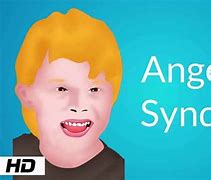 Image result for Signs of Angelman Syndrome