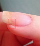Image result for How to Fix Broken Nail