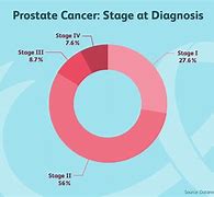 Image result for Prostate Cancer Stages