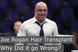 Image result for Joe Rogan Hair Transplant