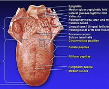 Image result for Tongue Disease