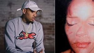 Image result for Chris Brown After He Hit Rihanna