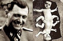 Image result for Mengele Conjoined Twins