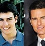 Image result for Tom Cruise Surgery