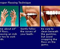 Image result for Tooth with Floss Lasso