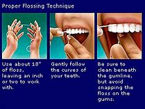 Image result for Teeth Flossing Tools
