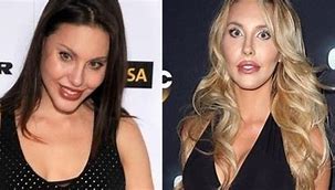 Image result for Chloe Rose Lattanzi Before After