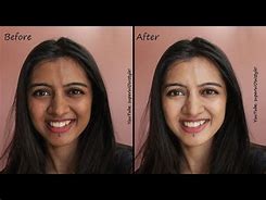 Image result for Indian Skin Lightening
