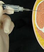 Image result for Intramuscular Injection