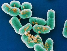 Image result for Listeria Monocytogenes Microscope