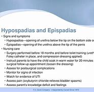 Image result for Difference Between Hypospadias and Epispadias