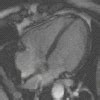 Image result for Risonanza Magnetica Cervice