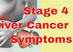 Image result for Lung Liver Cancer Stage 4