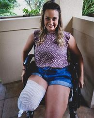 Image result for One Leg Amputee Woman Facebook