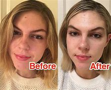 Image result for Boots Vitamin C Serum Before and After