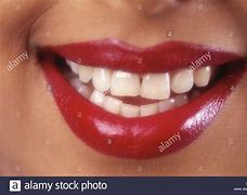 Image result for Sparkling Teeth