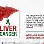 Image result for Primary Liver Cancer Stages