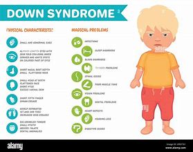 Image result for Down Syndrome Illustration
