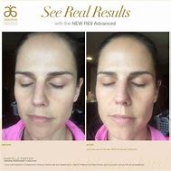 Image result for Arbonne Advanced RE9 Results