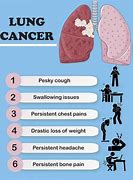 Image result for Signs of Stage 4 Lung Cancer