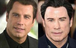 Image result for John Travolta Plastic Surgery Nightmare