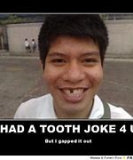 Image result for Tooth Gap Jokes