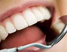 Image result for Oral Health