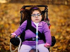 Image result for Famous Person with Gaucher Disease