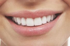 Image result for Smile Bright Teeth Whitening