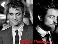 Image result for Robert Pattinson Nose