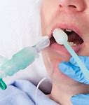Image result for Intubated Oral Care