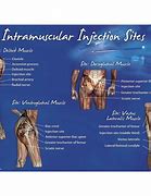 Image result for Common IM Injection Sites