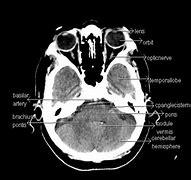 Image result for Human Anatomy CT