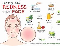 Image result for How to Get Rid of Pimple Redness