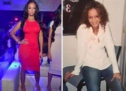 Image result for Erica Mena Before Surgery