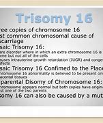 Image result for Trisomy 16