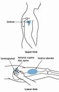 Image result for Intramuscular Injection Locations