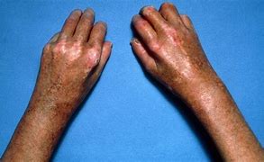 Image result for Problem Skin Conditions