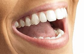 Image result for Mouth Health