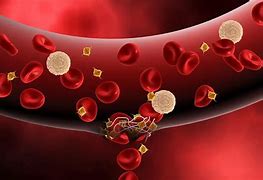 Image result for Hemophilia Cells